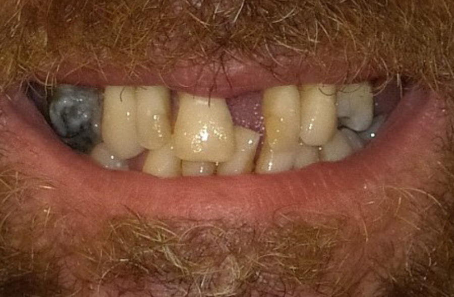 Before: a Regency Square Dental patient's smile prior to treatment.