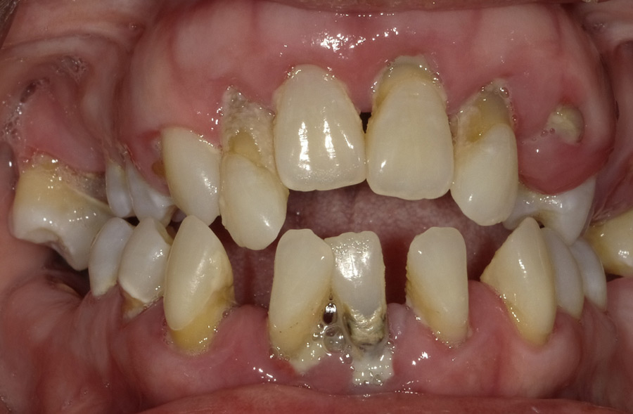 Before: a Regency Square Dental patient's smile prior to treatment.