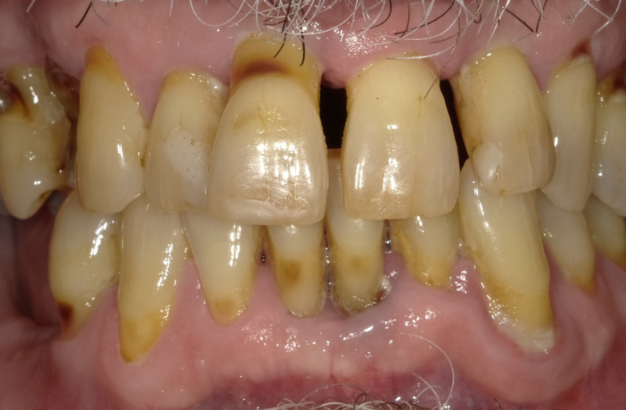 Before: a Regency Square Dental patient's smile prior to treatment.