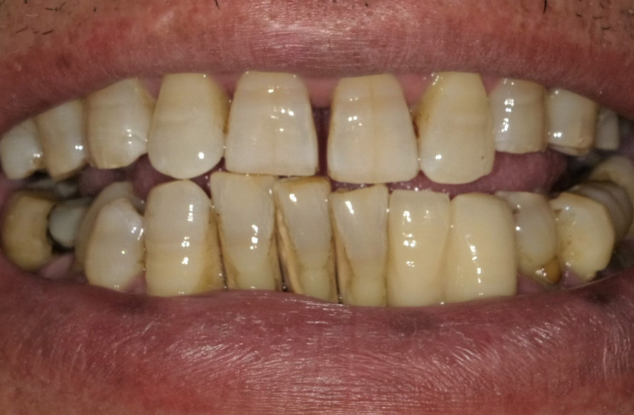 Before: a Regency Square Dental patient's smile prior to treatment.