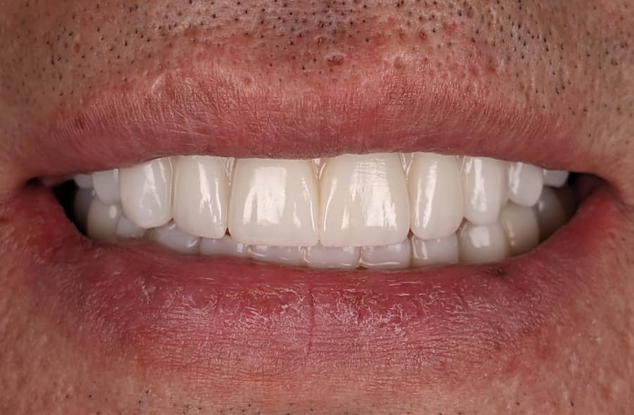 After: the same patient's completed Regency Square Dental restoration.