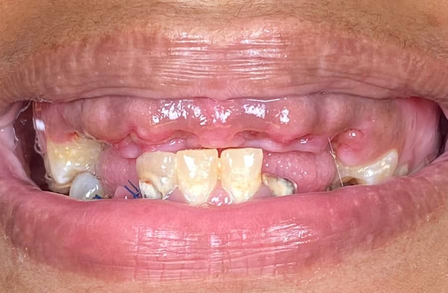 Before: a Regency Square Dental patient's smile prior to treatment.