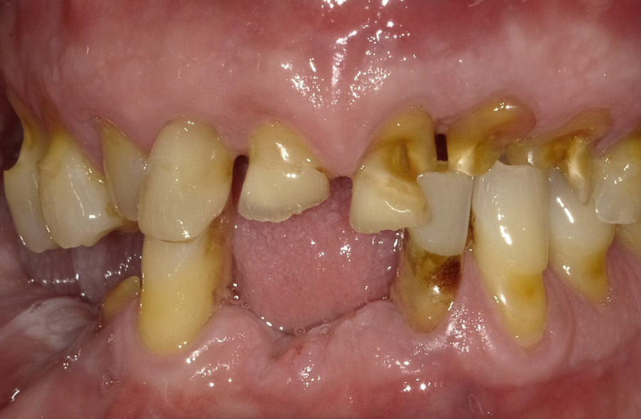 Before: a Regency Square Dental patient's smile prior to treatment.