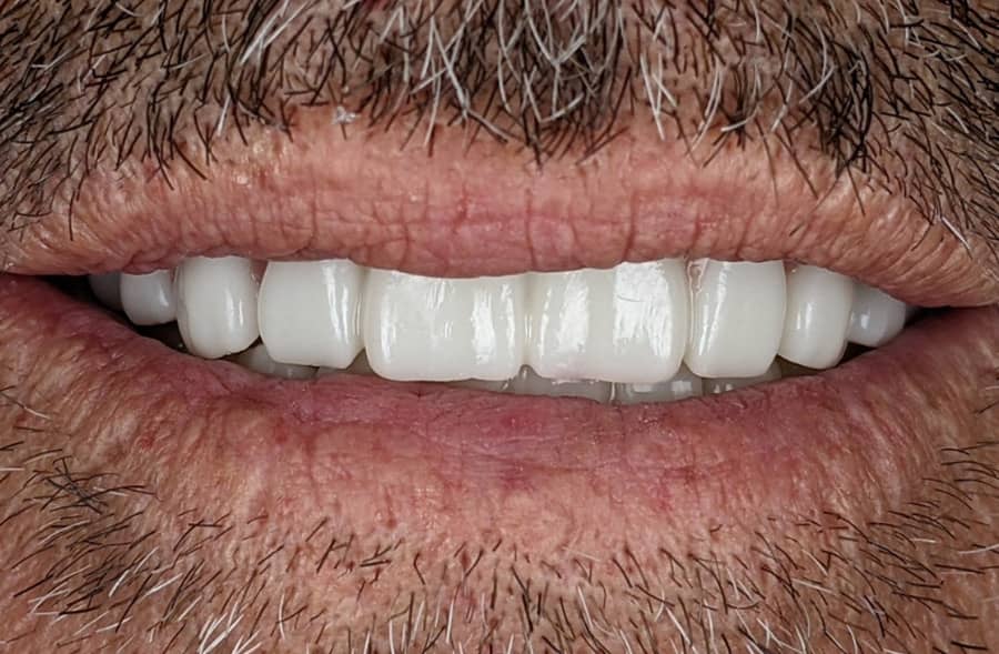After: the same patient's completed Regency Square Dental restoration.